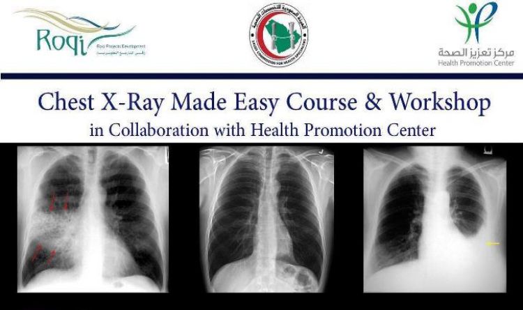 Chest XRAY Made Easy Course and Workshop