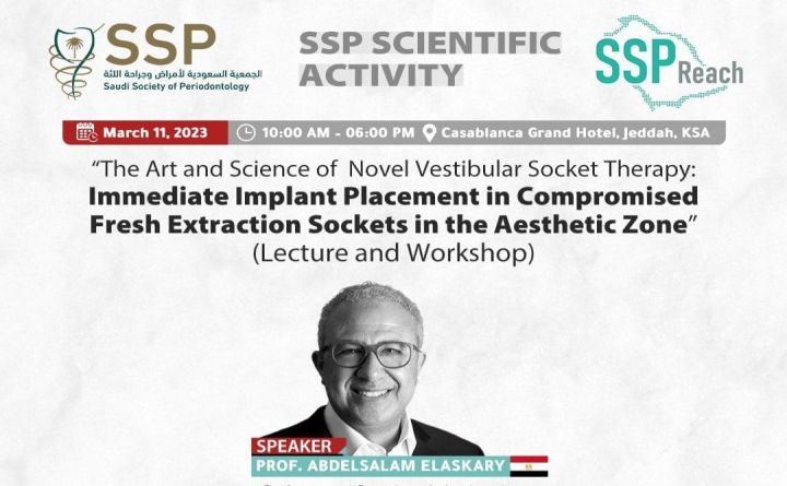 The Art and Science of Novel Vestibular Socket Therapy