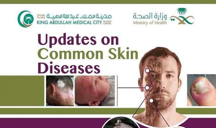 Updates on Common Skin Diseases